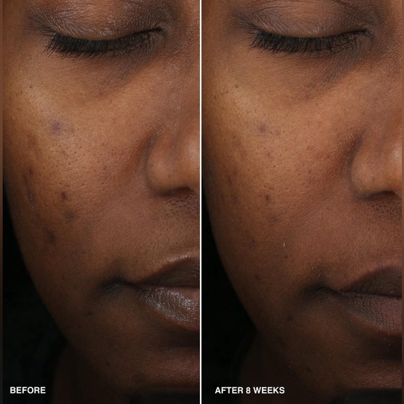 Bobbi Brown Vitamin Enriched Smoothing Serum Brand New in Box Authentic - Picture 5 of 13